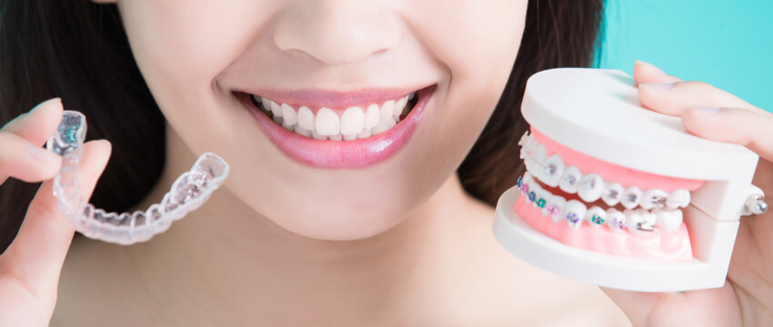 Invisalign Vs Braces Burwood