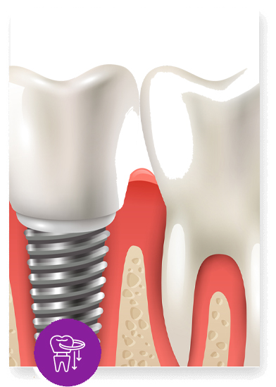 Dental Image