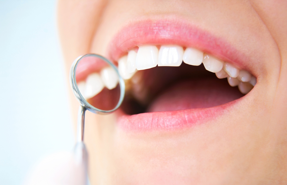 Close-up,Of,Young,Female,Having,Her,Teeth,Dental,Care