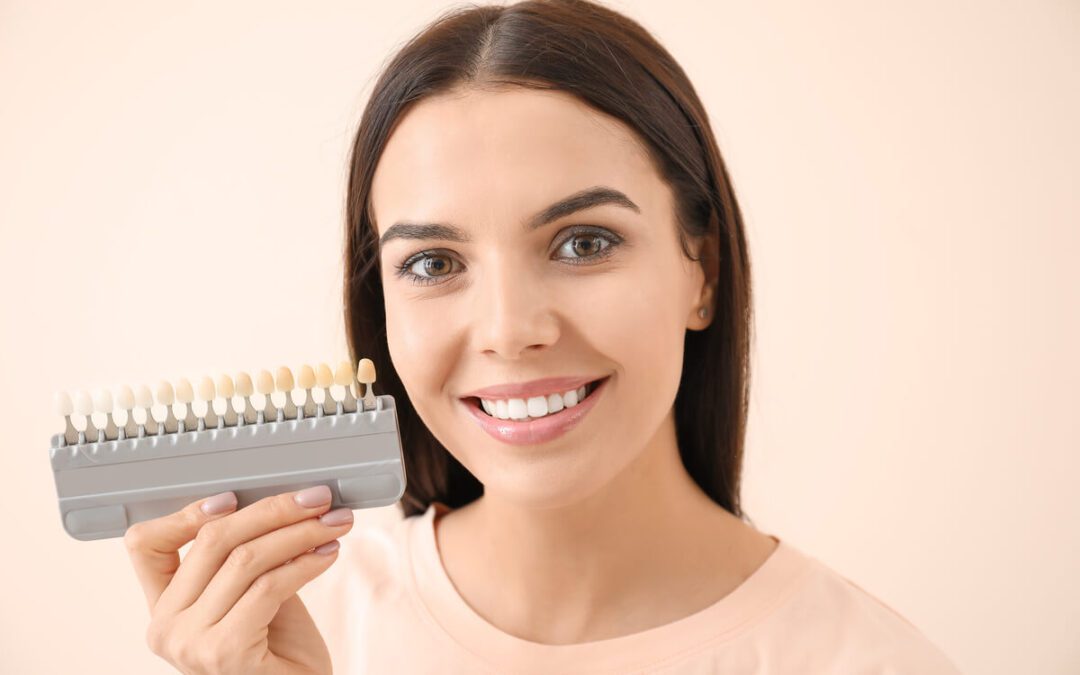 Porcelain Veneers Cost — What You Need to Know Before Getting Them?