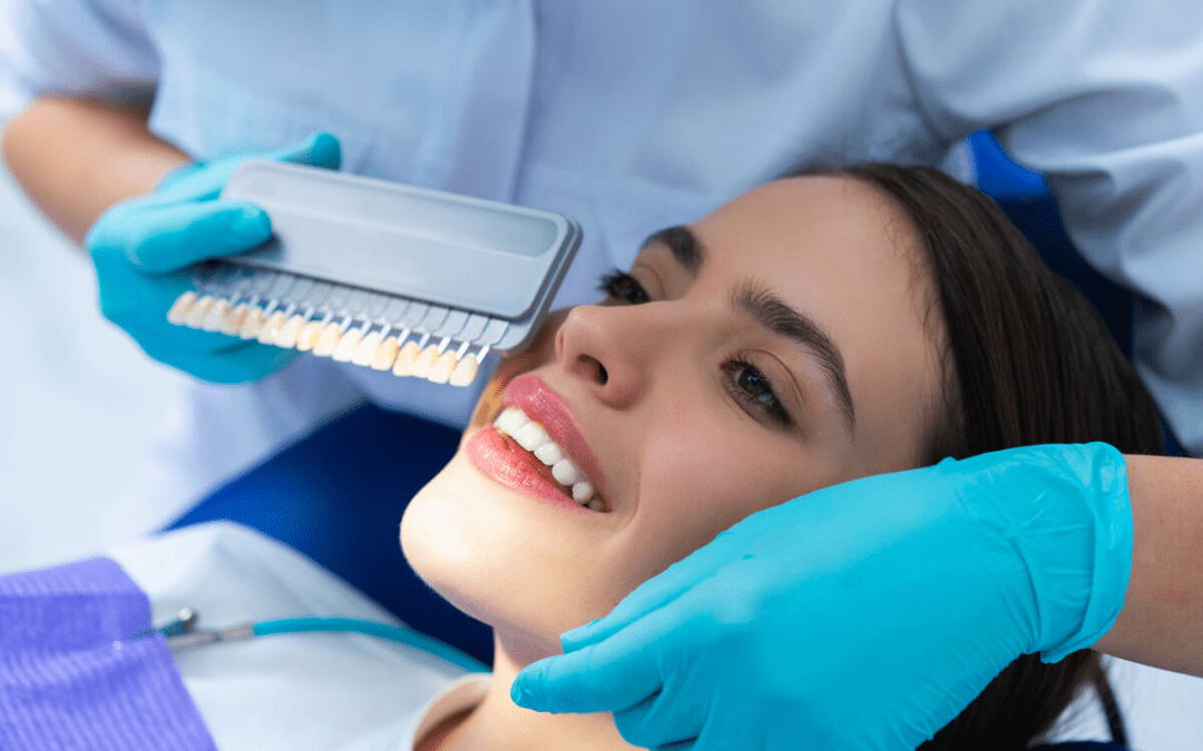 How Do Veneers Work: The Ultimate Guide to a Perfect Smile