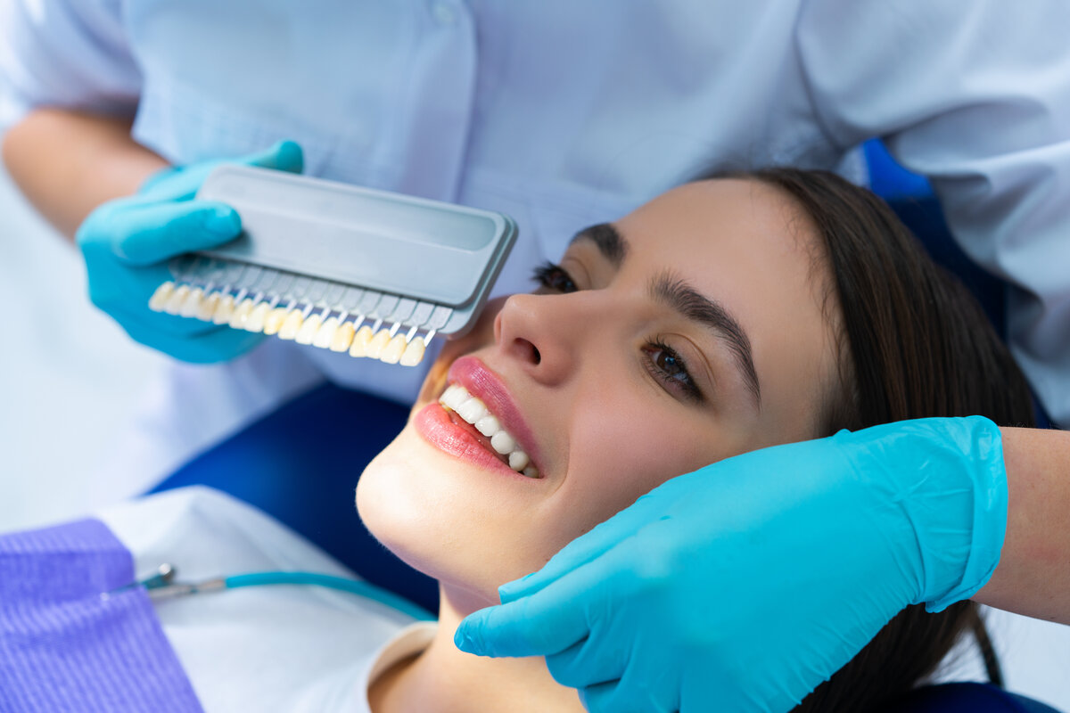 How Do Veneers Work The Ultimate Guide to a Perfect Smile