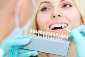 How Much Do Veneers Cost in bali crown colour burwood