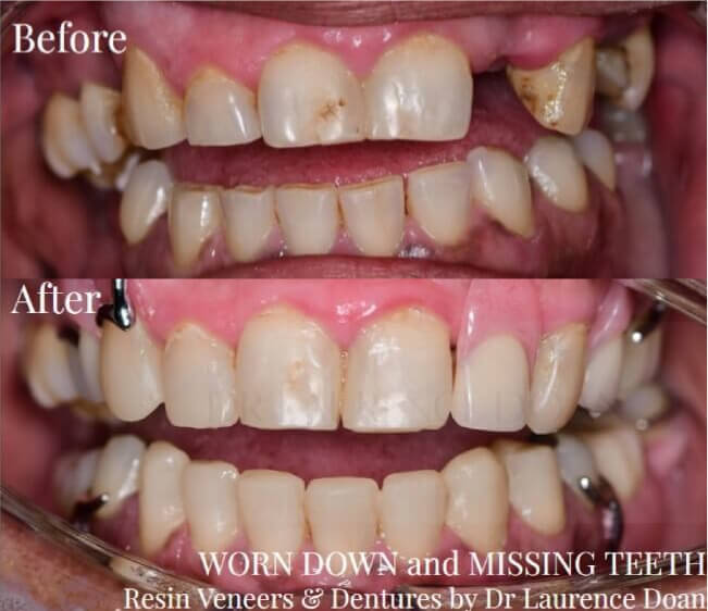 Before vs After-case-6 - D266