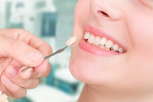 benefits of porcelain veneers burwood