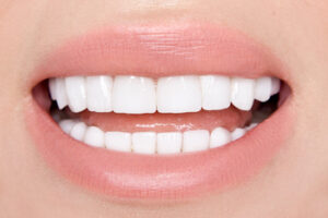 veneers payment installment burwood