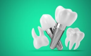 implant dentist abroad burwood