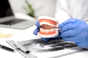 partial denture cost consultation