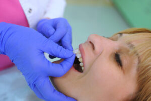 What Causes Root Canal check