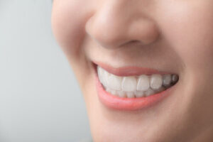 Are Teeth Whitening Strips Safe wear