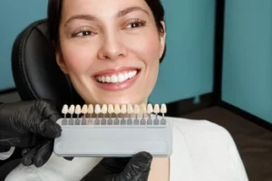 Can Veneers Fix Overbite color