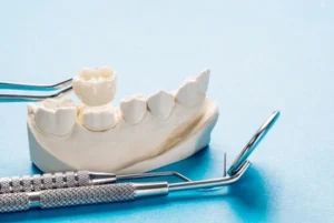 Dental Crown Front Tooth check