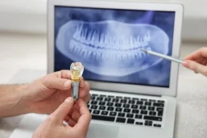 titanium teeth implants procedure