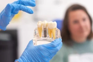 dental implant consultation photo
