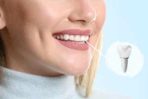 implant abutment and crown in patient