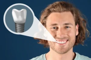 patient showing bone graft before dental implant